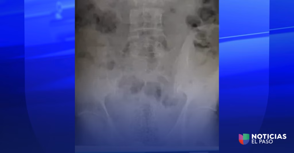 En menos de 48 horas, CBP arresta a un hombre en el puente internacional de Ysleta por intentar introducir droga en su cuerpo
