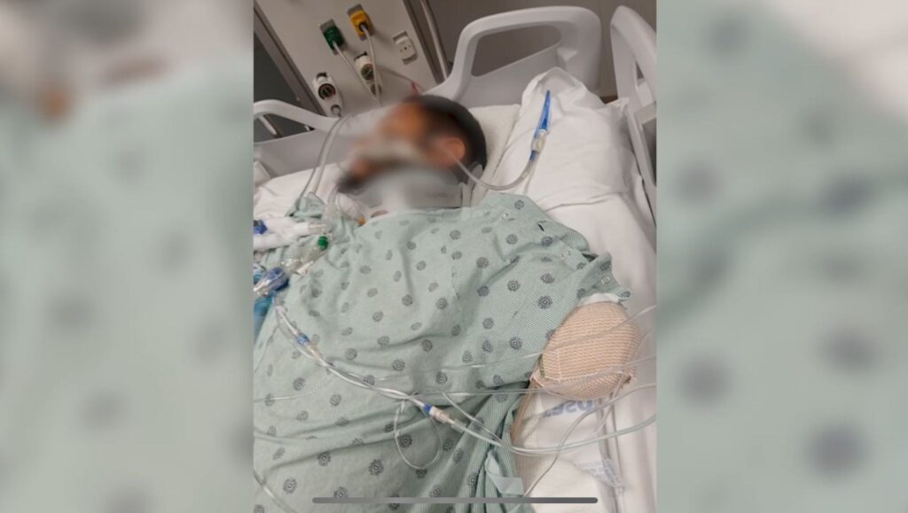 Accidente en Tornillo:Padre de 5 pierde brazo y lucha por su vida tras volcadura