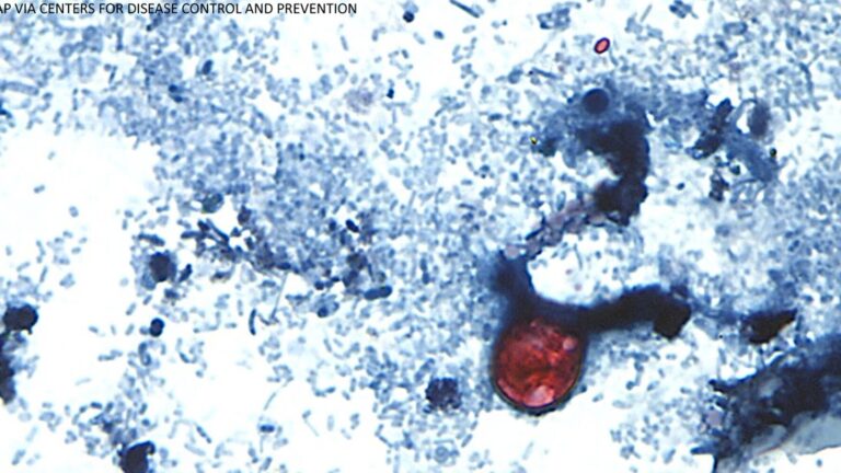 Autoridades de salud confirman caso de ciclosporiasis en El Paso; no hay riesgos a la comunidad