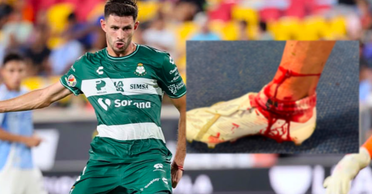 Santos Laguna alzará la voz ante Concacaf y la organización de la Leagues Cup tras fuerte lesión de Di Yorio