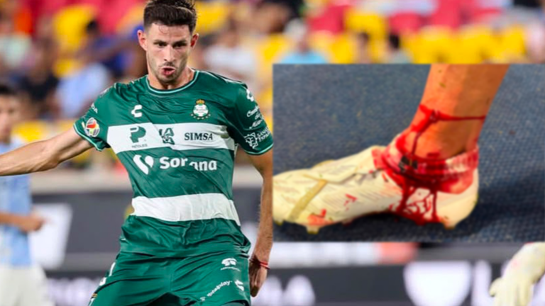 Santos Laguna alzará la voz ante Concacaf y la organización de la Leagues Cup tras fuerte lesión de Di Yorio